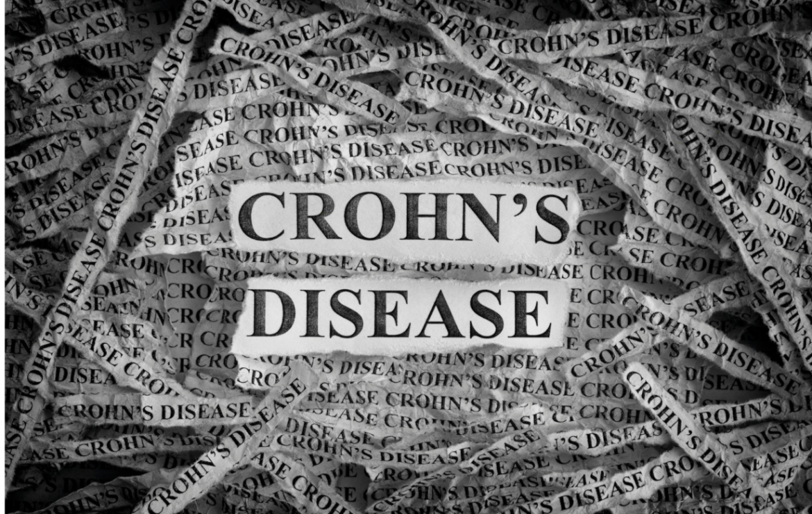 L’ostéopathie et la maladie de Crohn